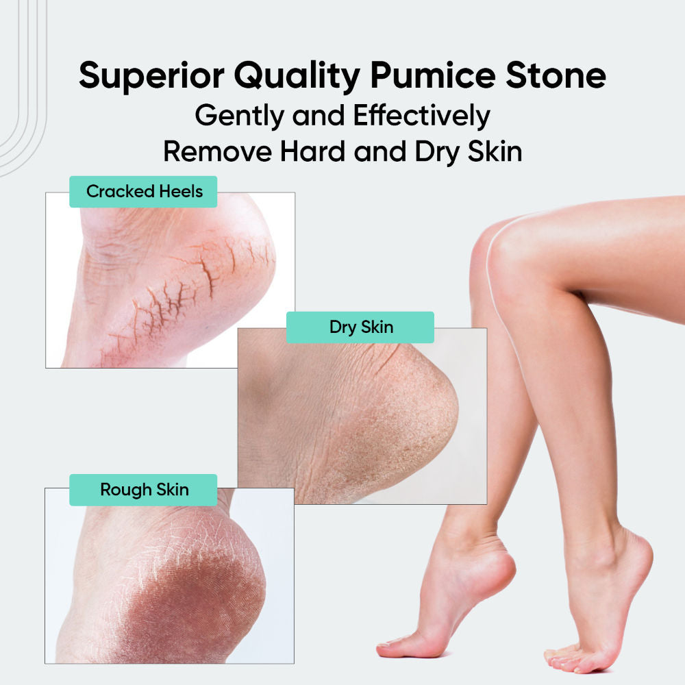 Pumice Stone (PD16) (Colour May Vary)
