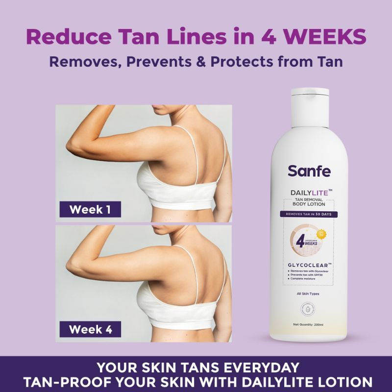 Dailylite Tan Removal Body Lotion For Women Remove Tan With SPF 30 Body Moisturizer Cream