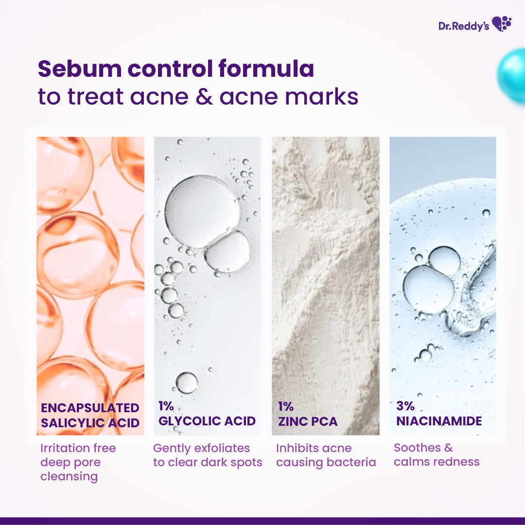 Acne Facewash With Sebum Control & Hydrating Formula