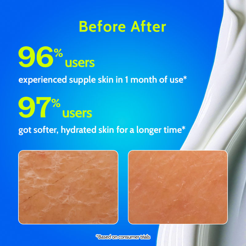 Hydrating Body Lotion with Rice Water & Hyaluronic Acid, Moisturizer for Dry Skin