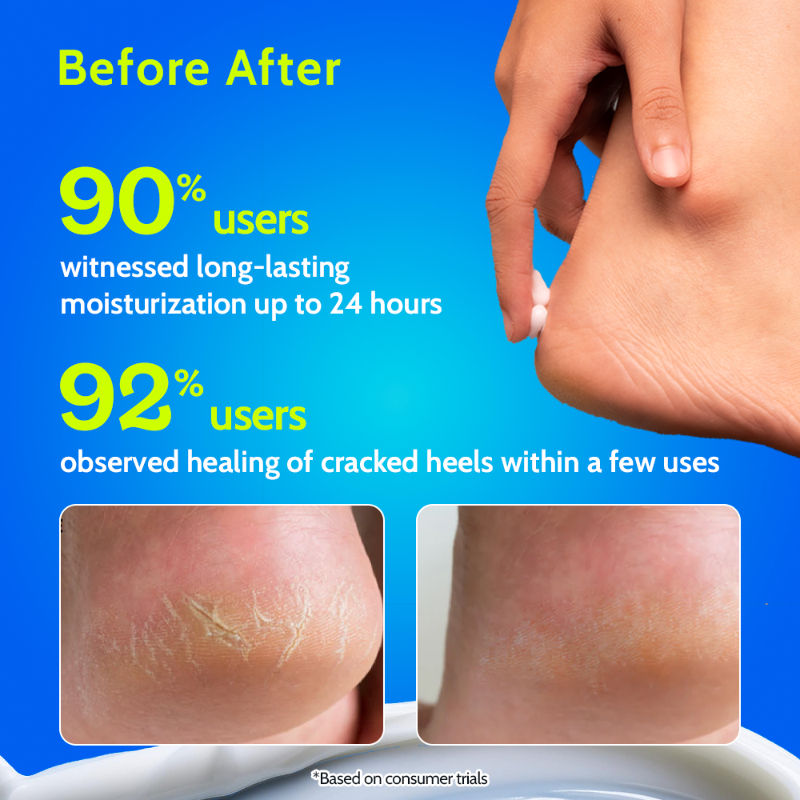 10% Urea Foot Cream For Cracked Heels & Diabetic Foot Up to 24 Hours Of Moisturization