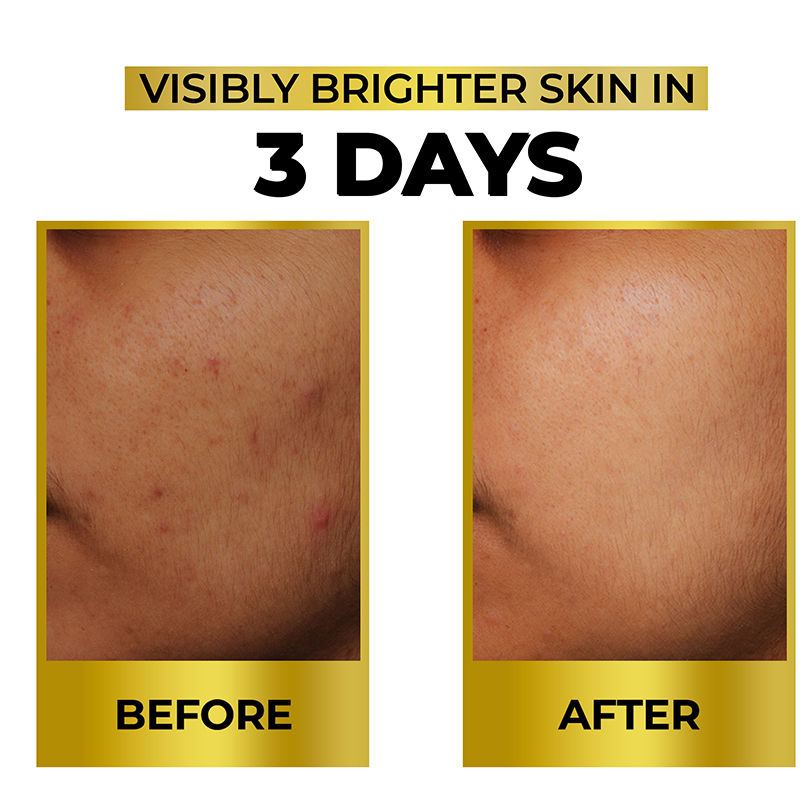 Bright & Shine Face Serum For Brightening, Dark Spots Reduction