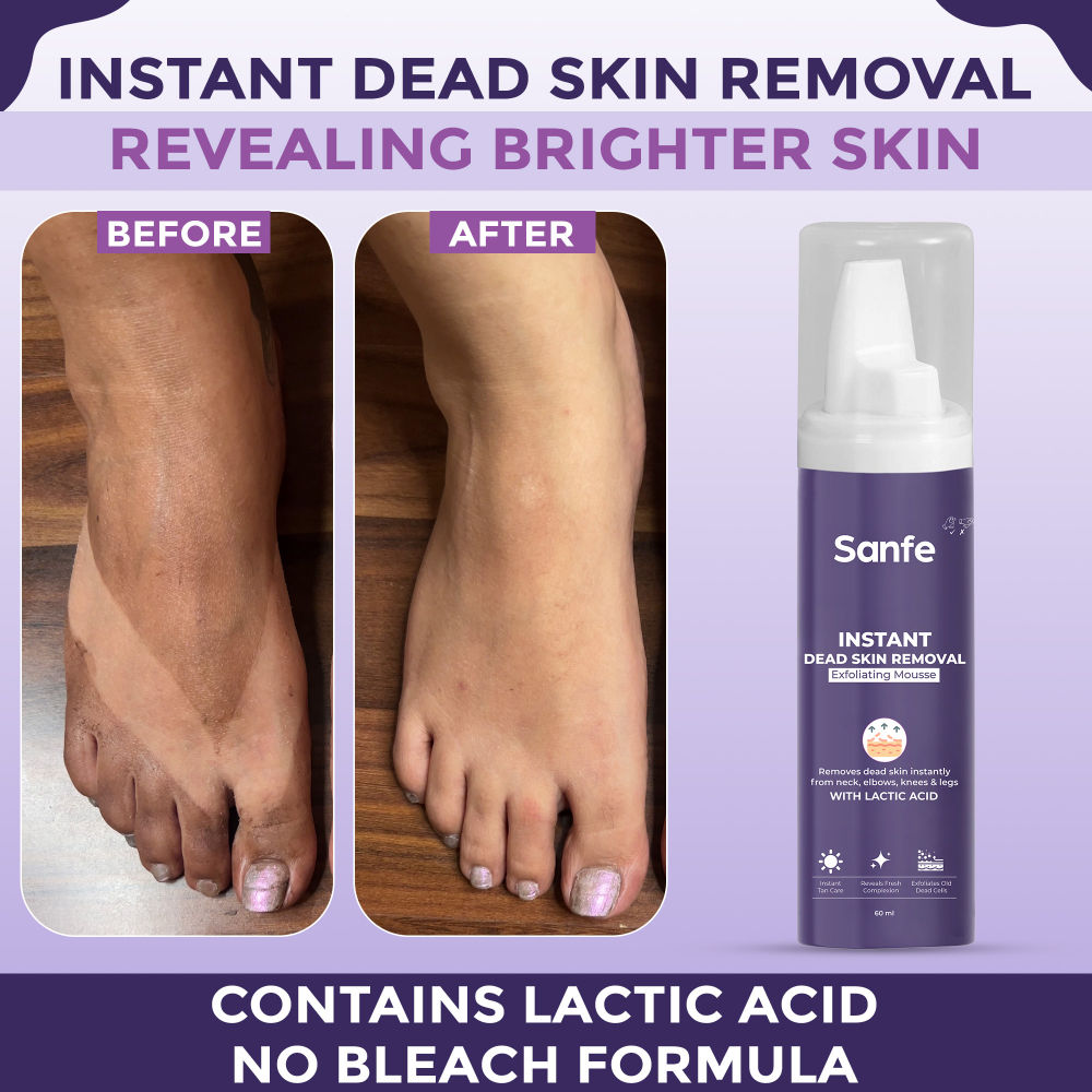 Instant Dead Skin Removal Exfoliating Mousse | Visibly Removes Tan, Exfoliates - 60 ml