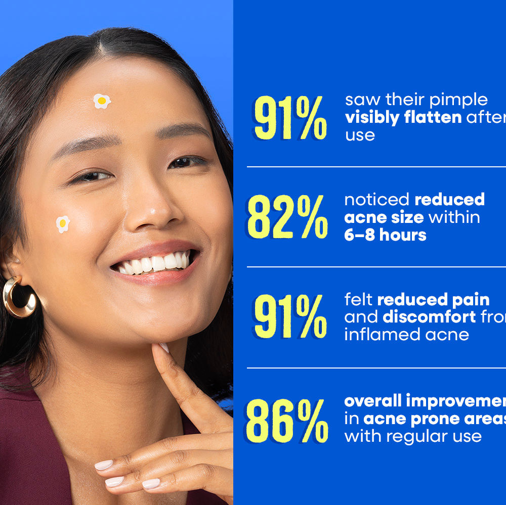 Goodbye Blemish Acne Spot Patches
