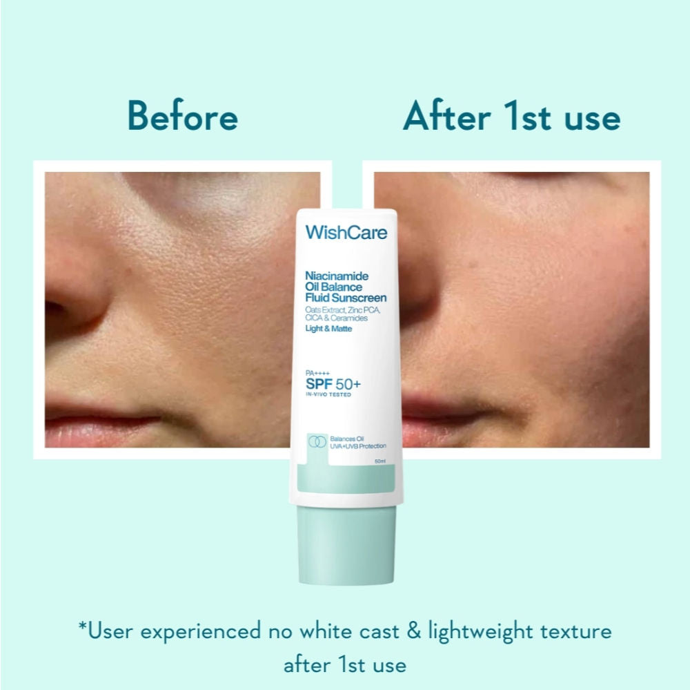 Niacinamide Oil Balance Fluid Face Sunscreen for Oily Skin with SPF50 PA++++ In-Vivo Tested