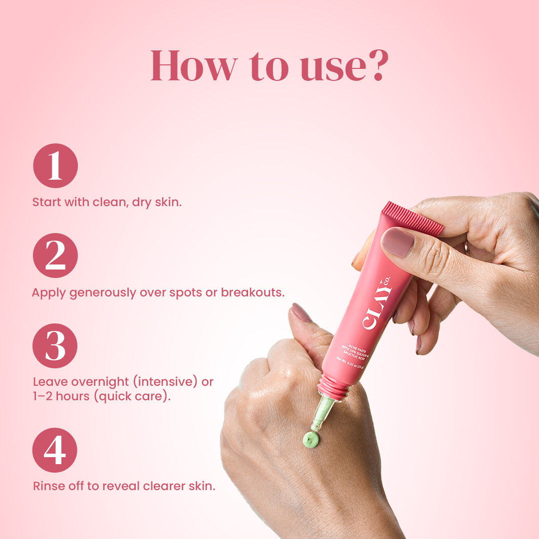 Acne Paste With 10% Sulfur & Salicylic Acid