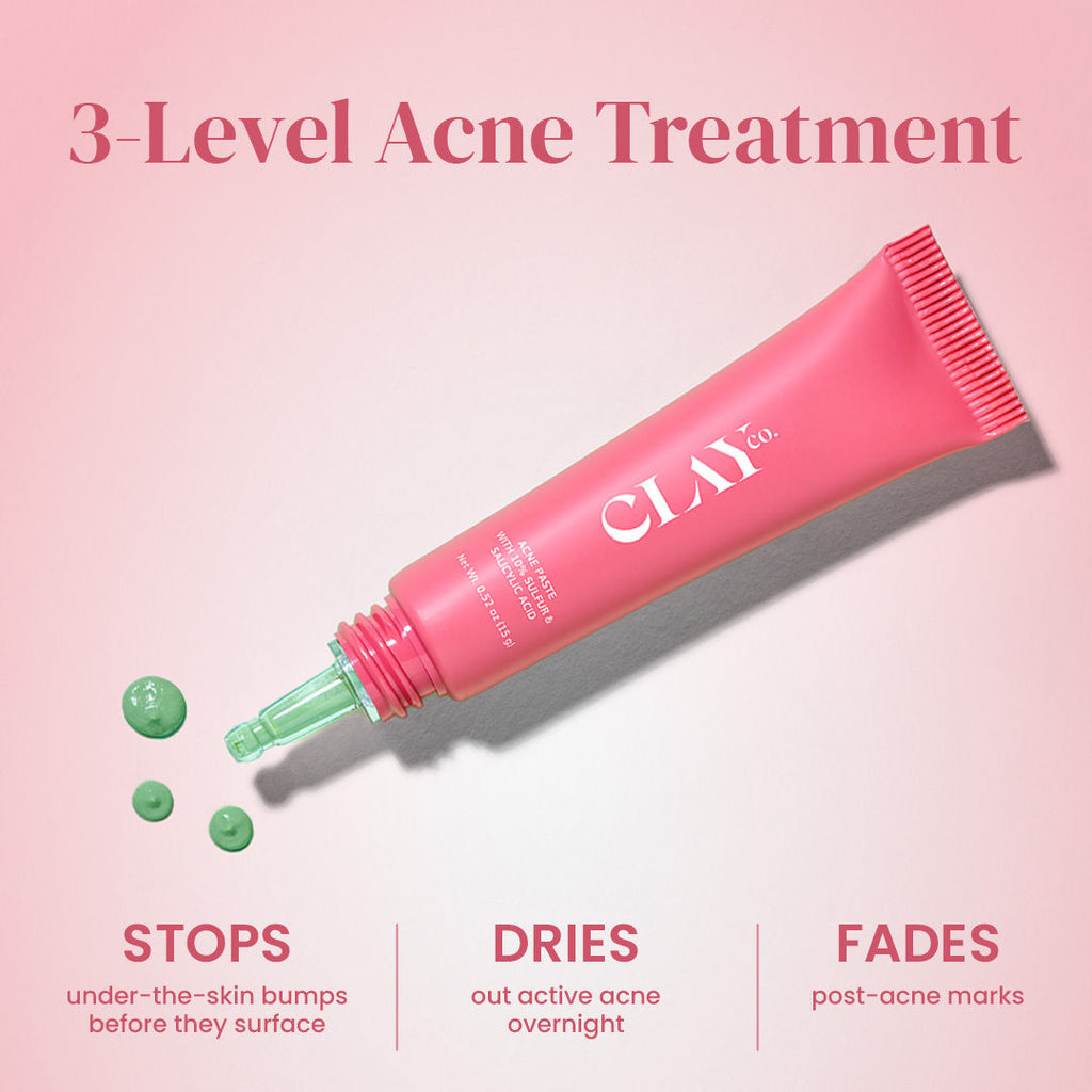Acne Paste With 10% Sulfur & Salicylic Acid