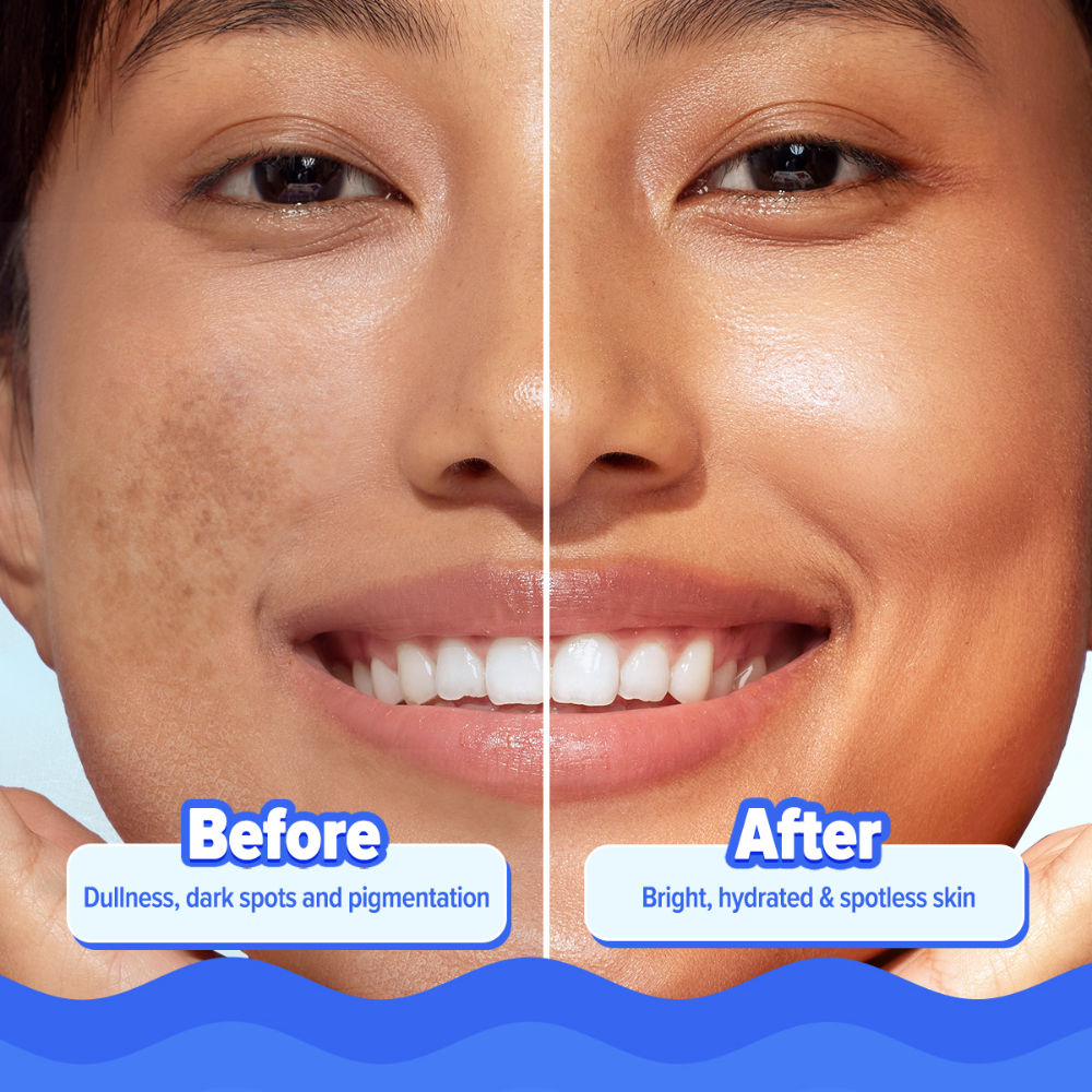 Bright+ Hydra Gel Moisturizer