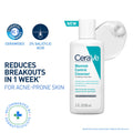 Blemish Control Cleanser With 2% Salicylic Acid & Niacinamide For Acne-Prone Skin - 88ml
