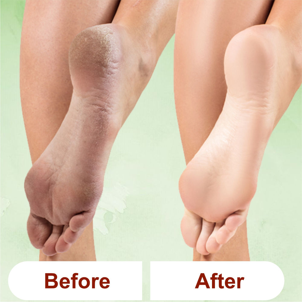 Lemon Grass Foot Scrub For Home Pedicure With Natural Oils And Foot Scrubber Tool