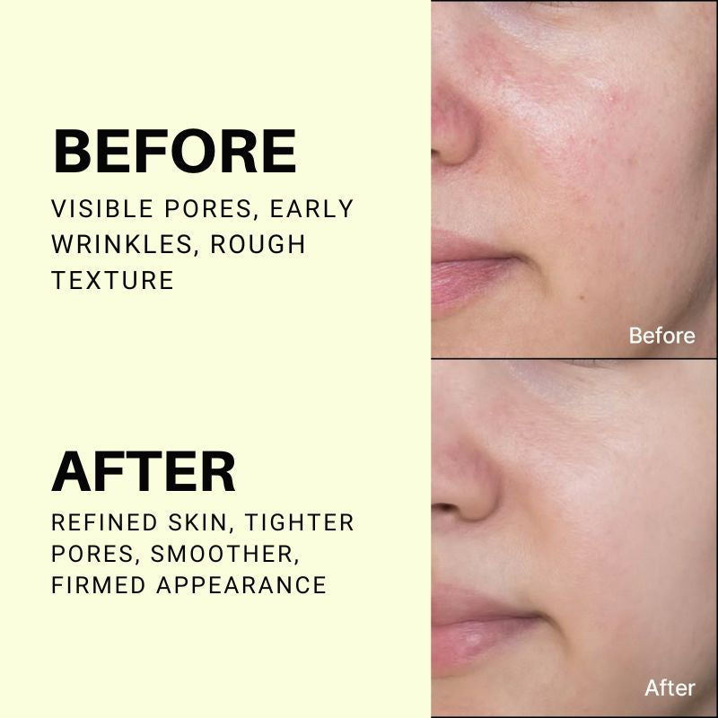 The Vita-A Retinol Shot Tightening Serum, For Anti-Aging, Dark Spots & Wrinkles