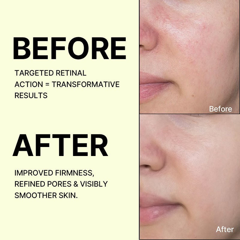 The Vita-A Retinal Shot Tightening Booster, For Anti-Aging, Dark Spots & Wrinkles