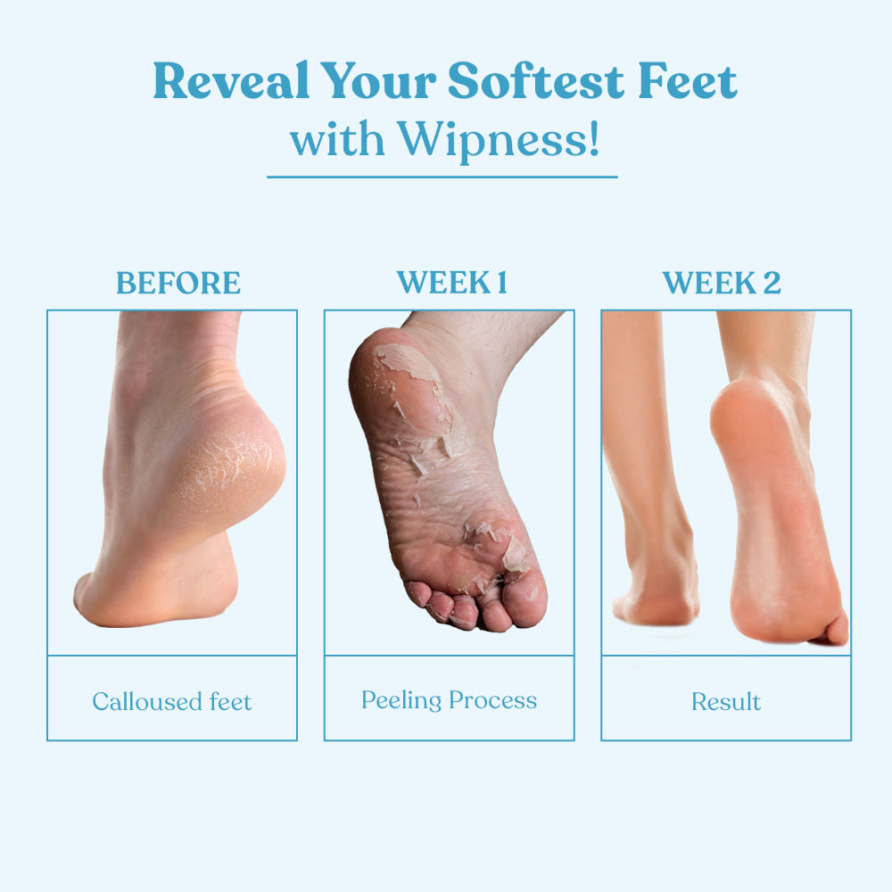 100% Natural Foot Peeling & Exfoliating Foot Mask