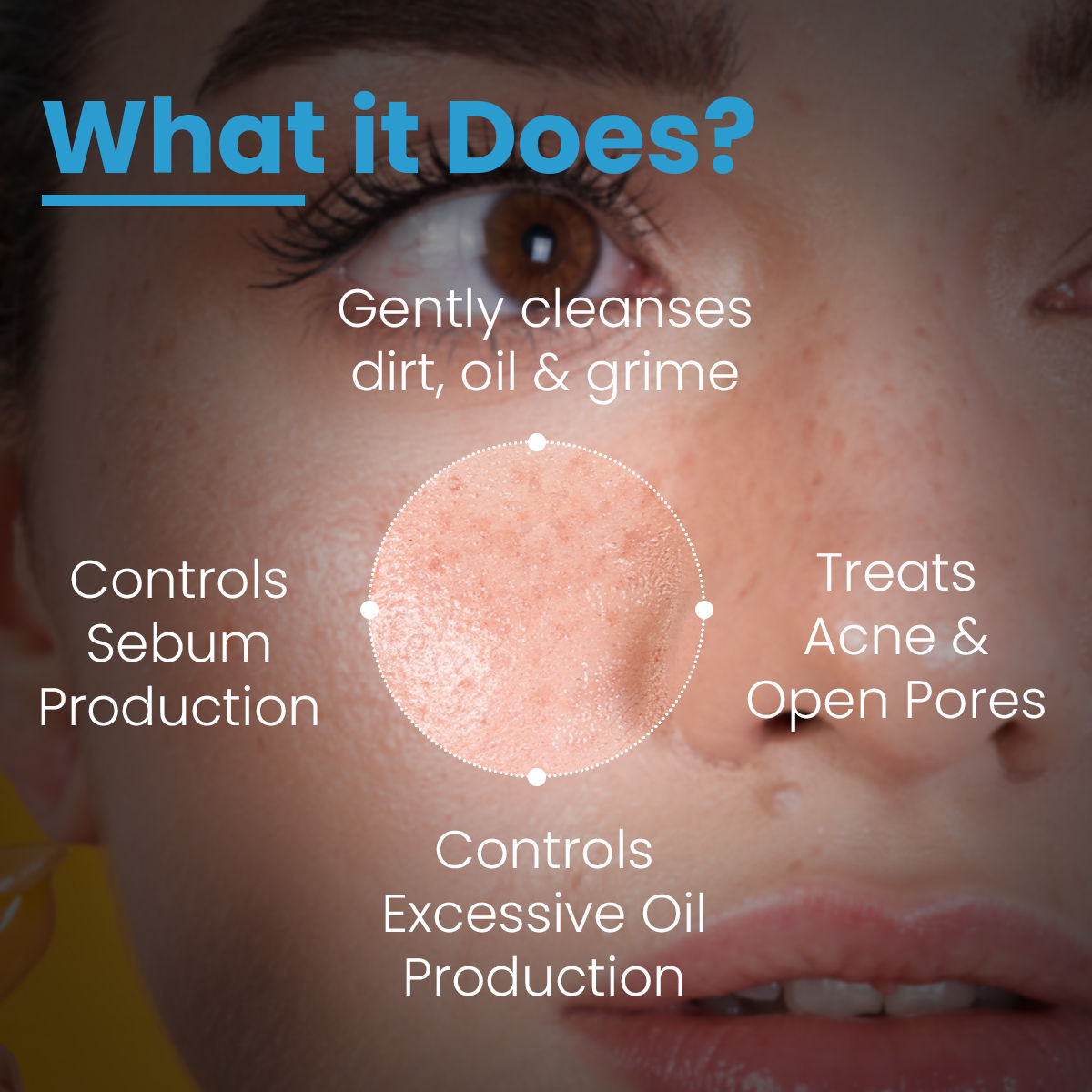FCL Alpha Beta Acne Cleanser, Reduces Pimples, Sebum, Deep Pore Cleansing & NonComedogenic