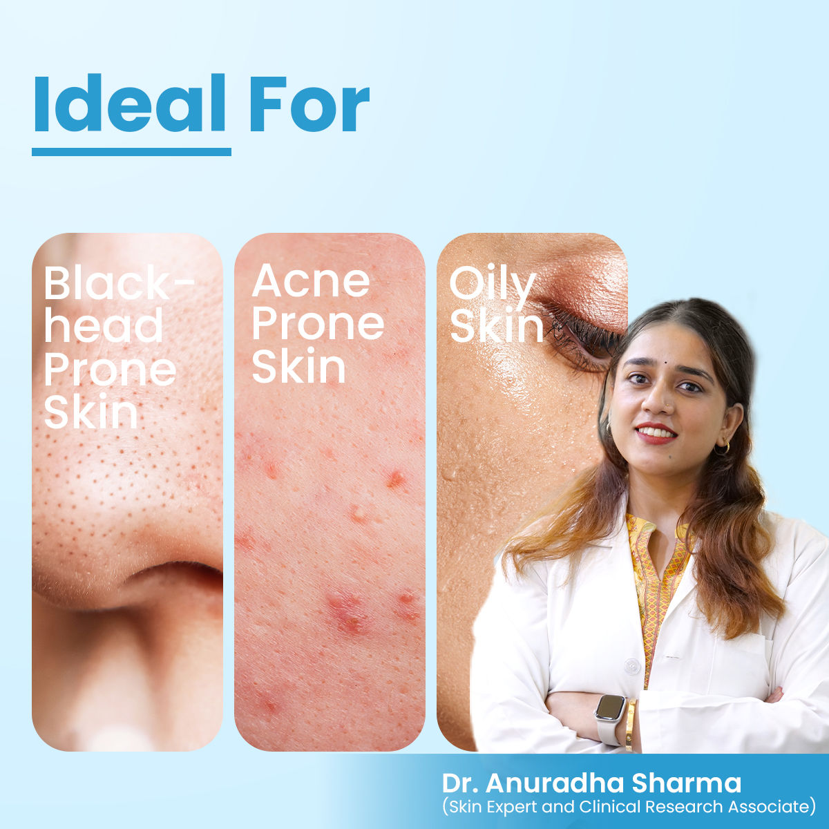 FCL Alpha Beta Acne Gel Adapalene with Glycolic Acid Treats Acne Pores For All Skin Types