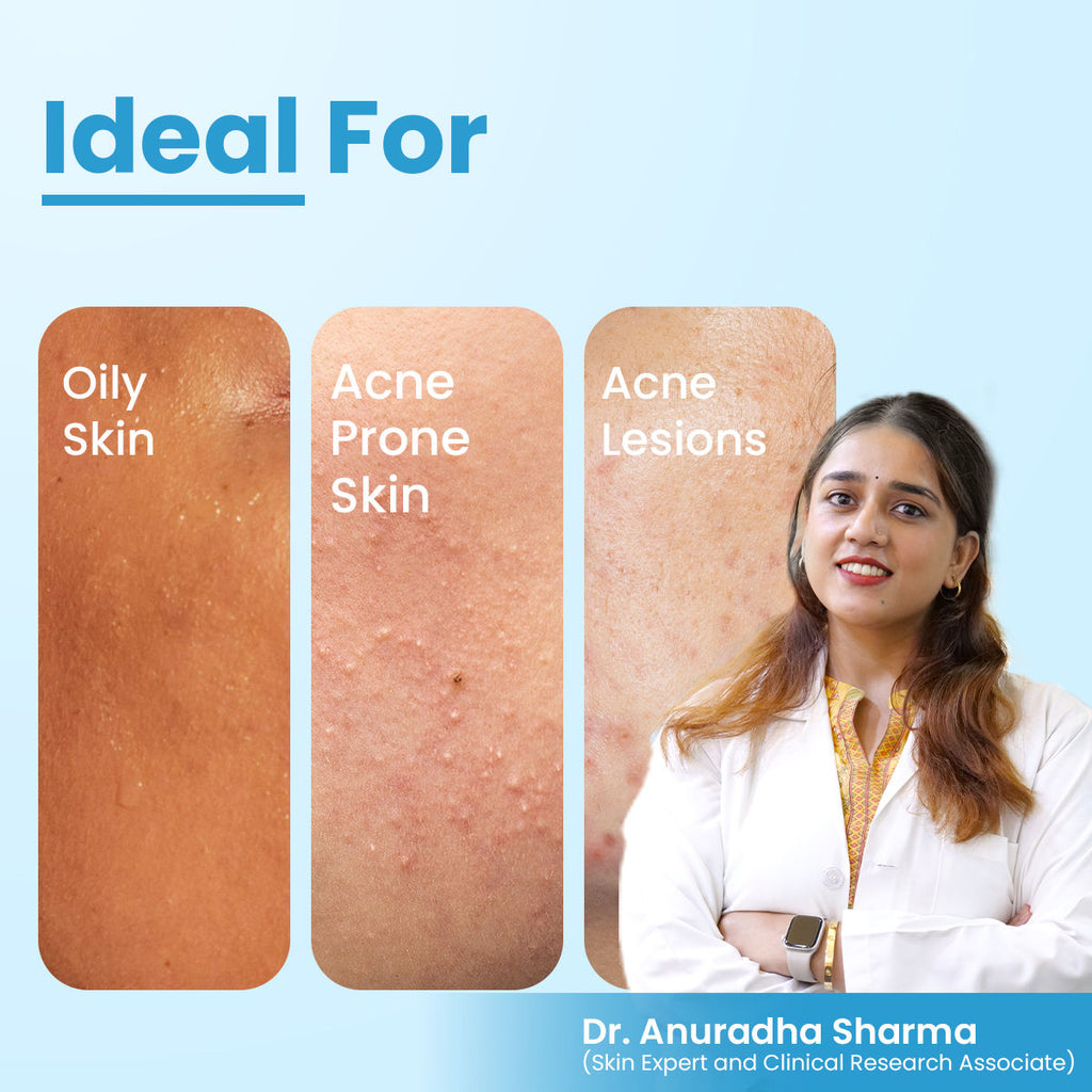 FCL 2% Benzoyl Peroxide BProx 10 Wash For Acne Exfoliate Blackheads Controls Cleanser