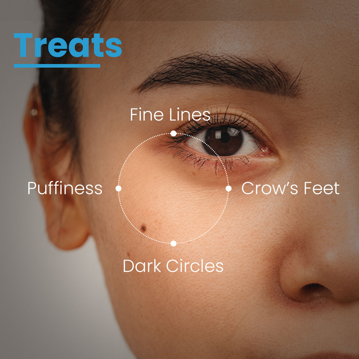 FCL Eye Refining Under Eye Gel For Dark Circles Puffiness with Vitamin C &Hyaluronic Acid