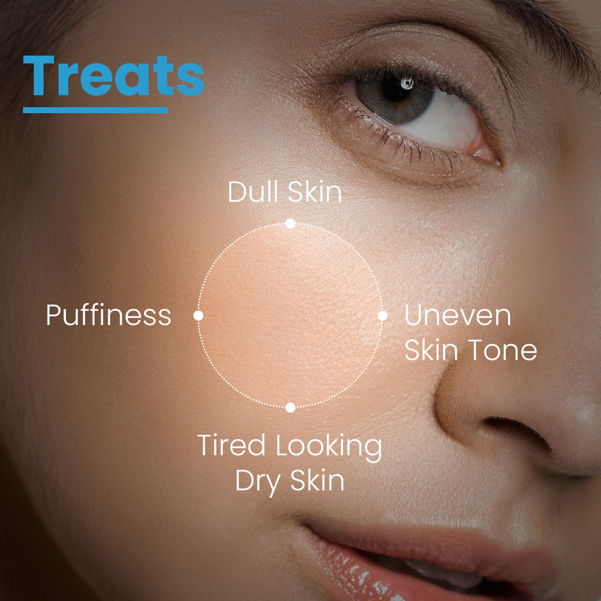 FCL Skin Brightening Complex Cream, Improves Skin Texture, Hyaluronic Acid, Alpha Arbutin