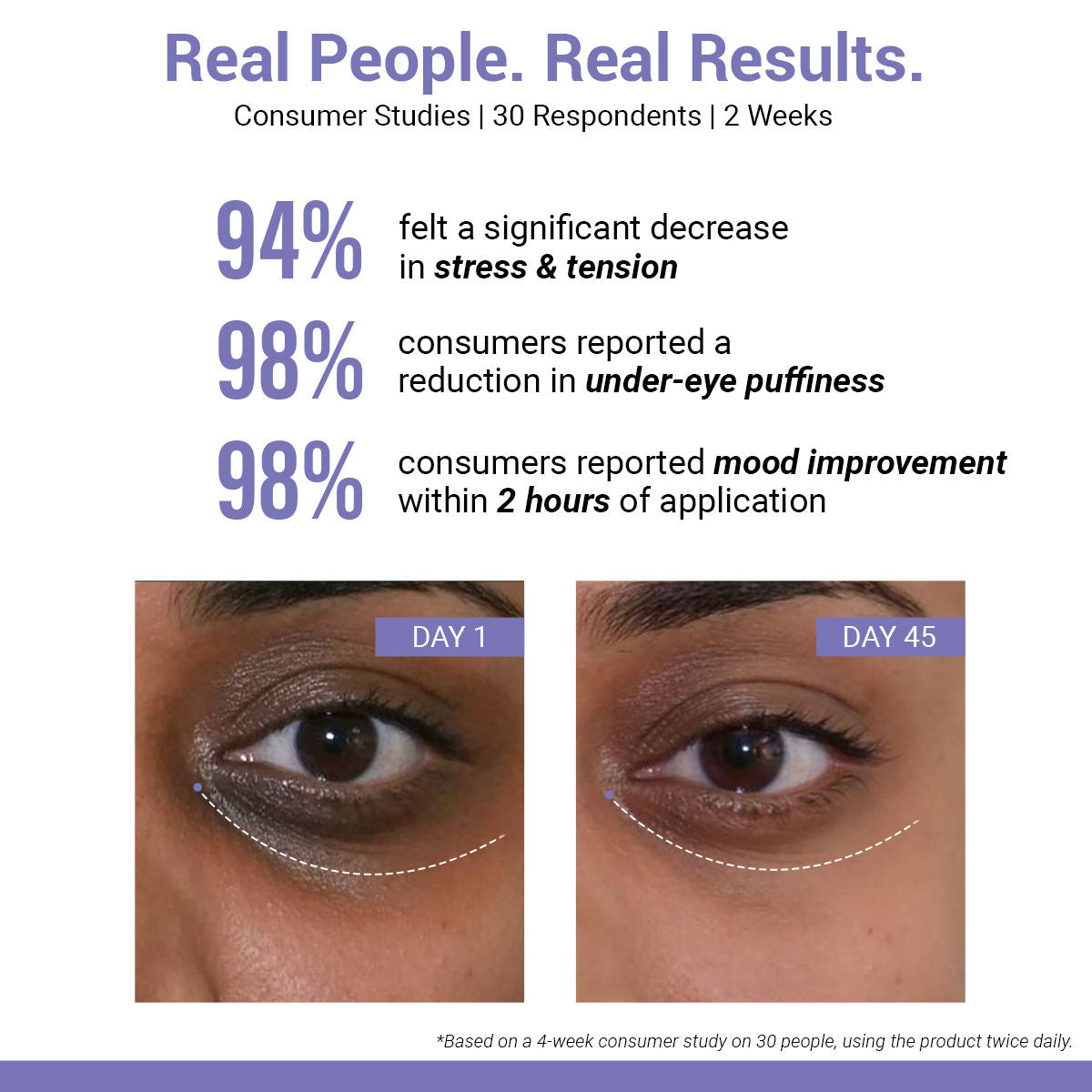 Gel Pen Under Eye Cream for Dark Circles, Puffiness, Stress Relief