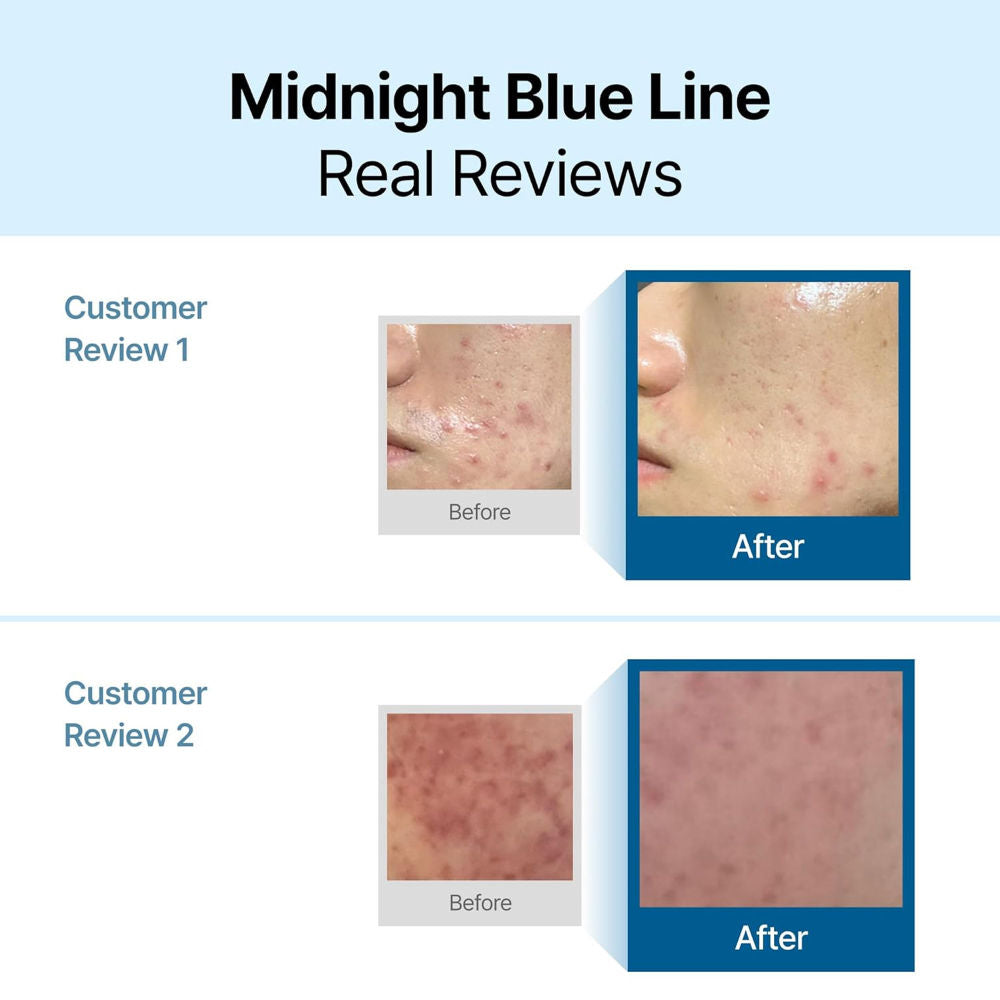 Midnight Blue Calming Cream