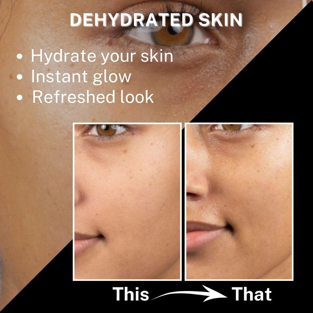 Tea Tree + Avocado Toner (oily To Combination Skin)