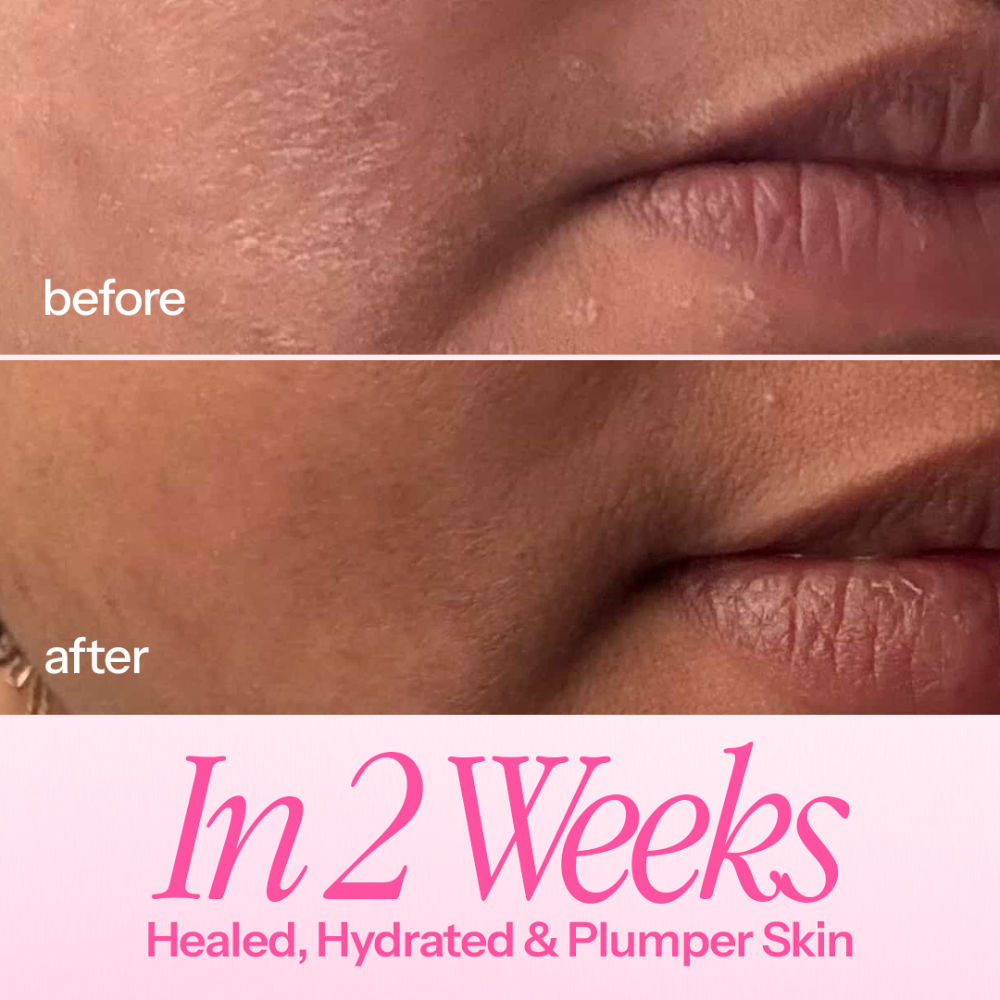 In My Defence Barrier-Building Moisturiser With 20x More Ceramides (Lightweight & Non-Greasy)