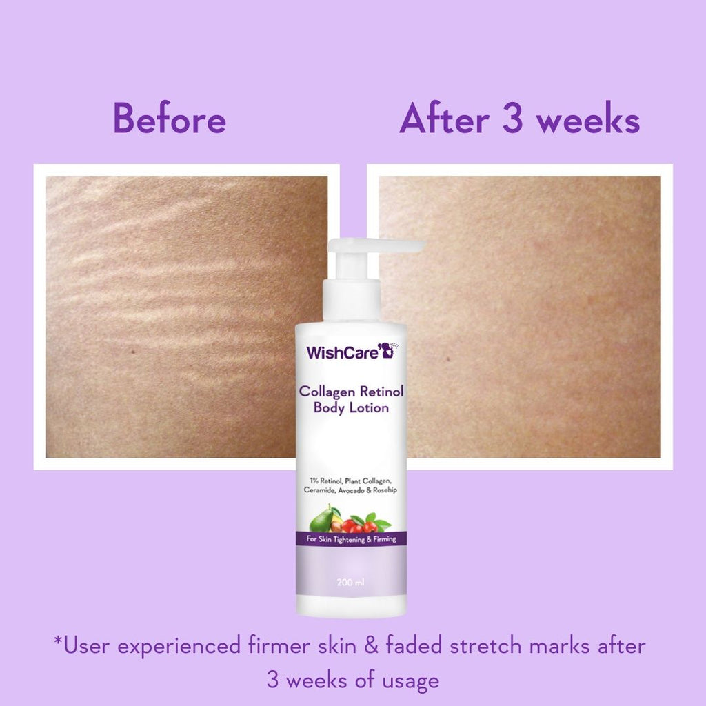 Collagen 1% Retinol Anti-Ageing Body Lotion With Niacinamide For Skin Tightening & Firming