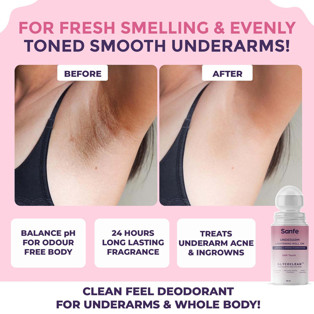 Underarm Lightening Roll On (Soft Touch) with 5% AHA