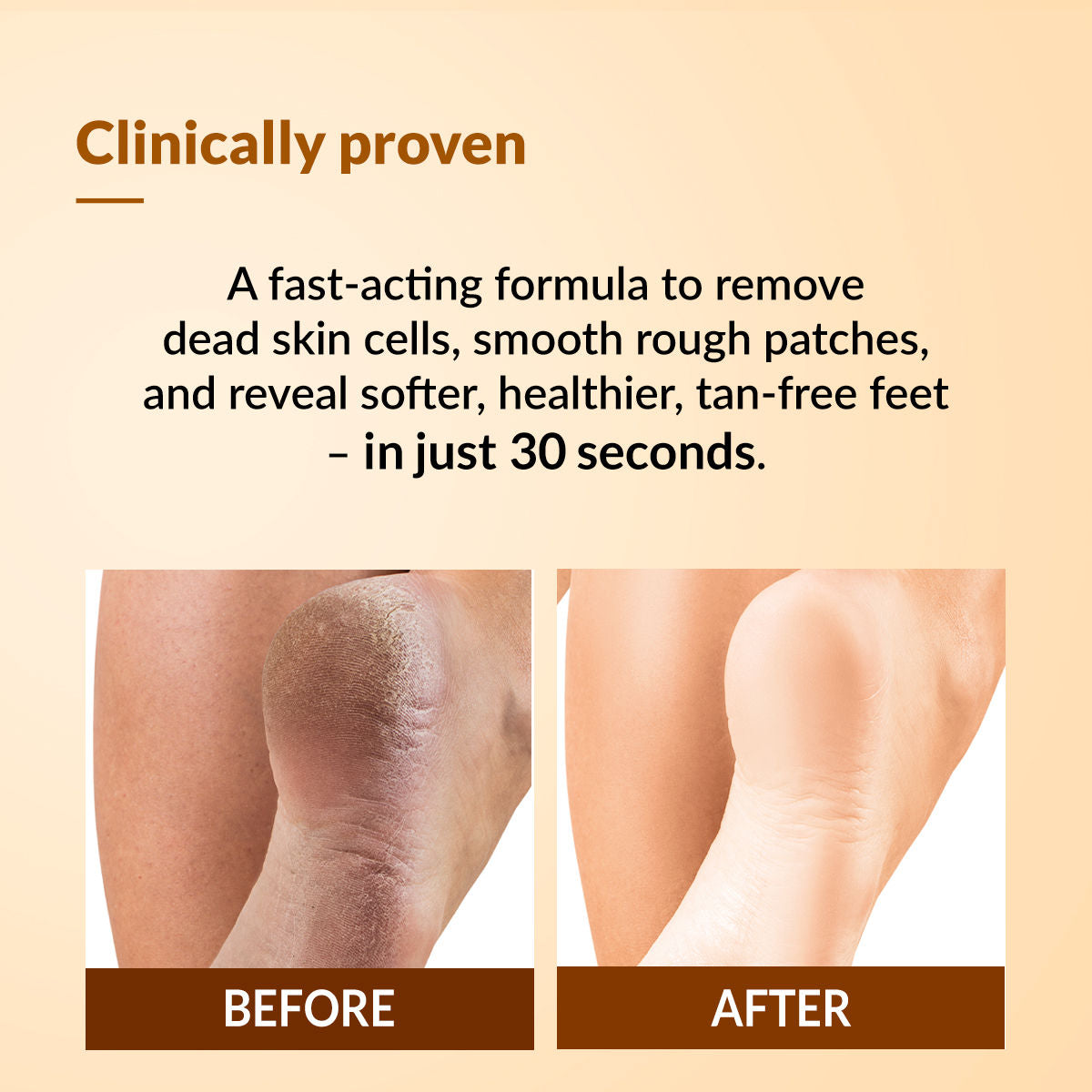 Foobetik Foot Scrub Spray with 5% Lactic Acid & Shea Butter for Smooth Heels