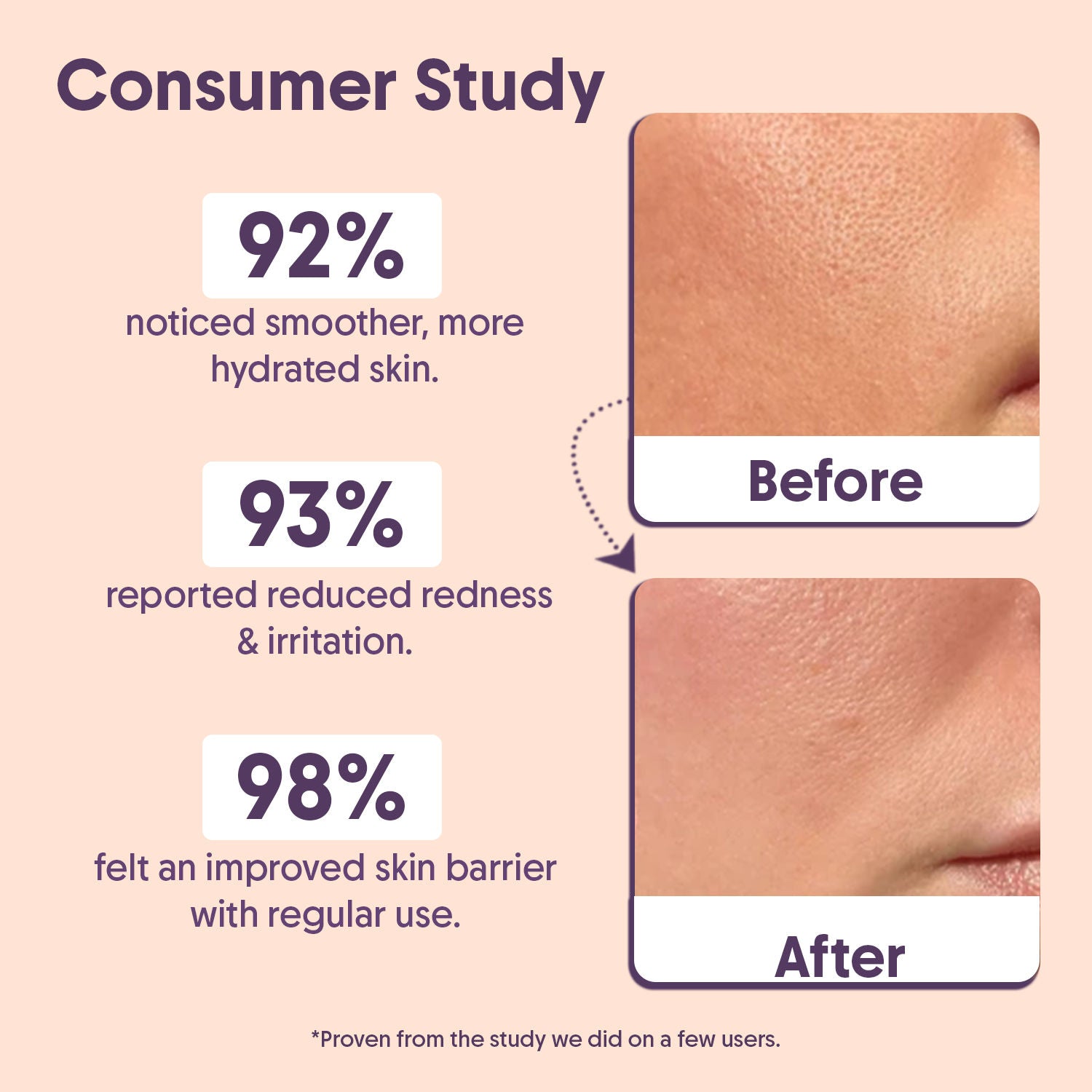 Barrier Repair Face Moisturiser, Ceramide & Niacinamide, Dry, Oily & Sensitive Skin