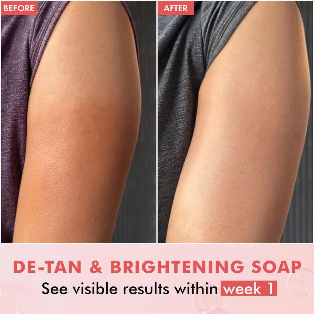 Brightening Tan Removal Soap - 1% Kojic Acid & Glutathione -Tangy Guava Perfume Syndet Bar