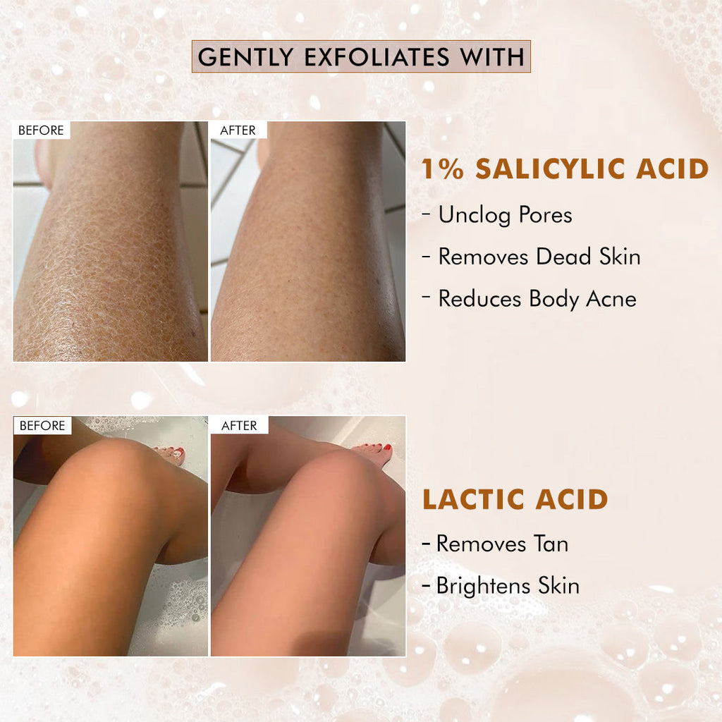 Exfoliating Tan Removal Soap - 1% Salicylic Acid & Lactic Acid - Sweet Caramel Perfume Bar