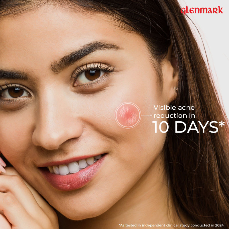 Soft Face Wash, Visible Acne Reduction in 10 Days, 2% Niacinamide & 1% Glycolic Acid