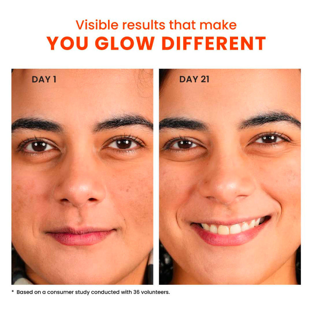 10% Vitamin C-Glutathione Brightening Face Serum For Glowing Skin, Dark Spots & Pigmentation