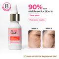 Dark Spot & Hyperpigmentation Face Serum - 15ml