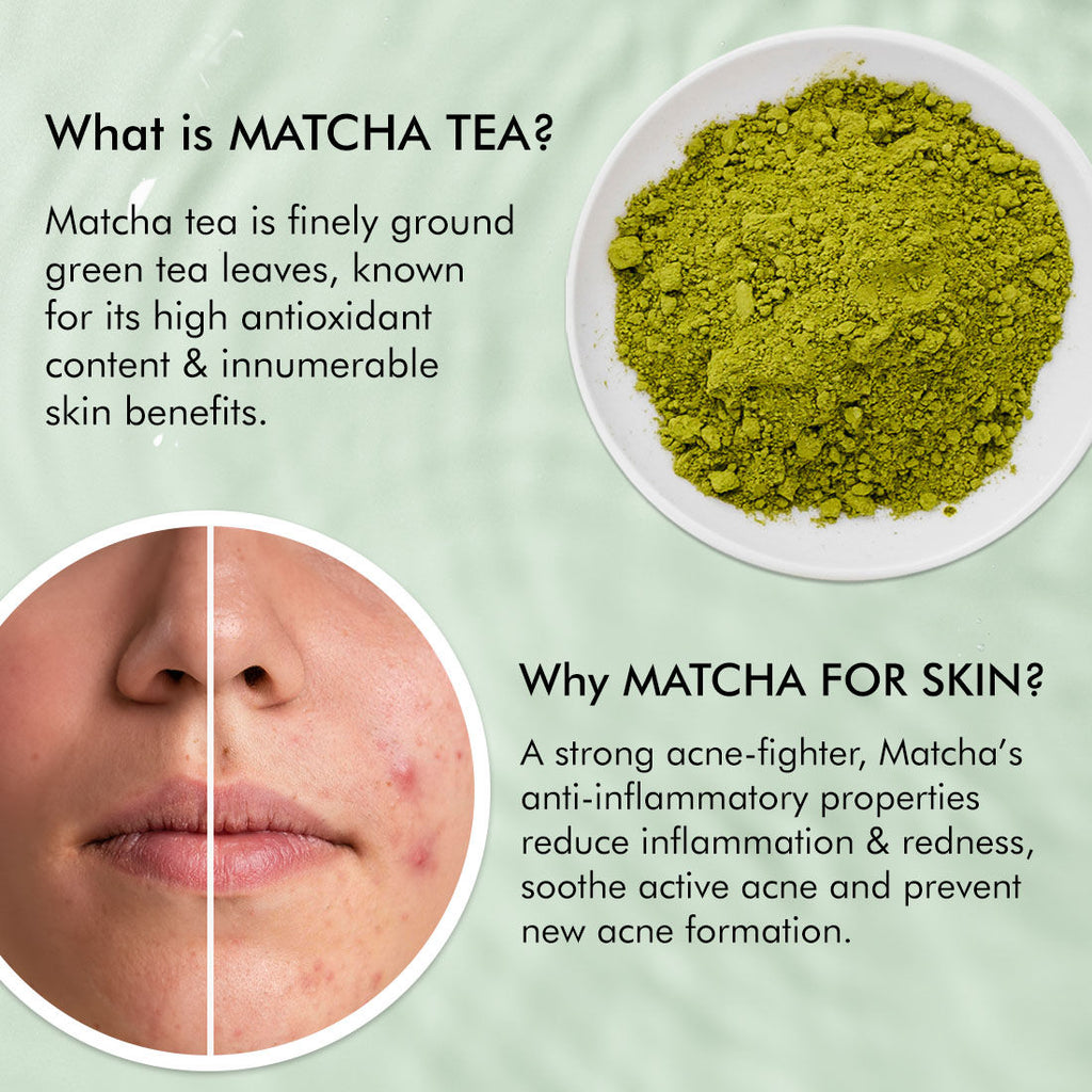 2% Salicylic Acid & Zinc Anti-Acne Pads For Clear Skin Serum Pads With Matcha Tea