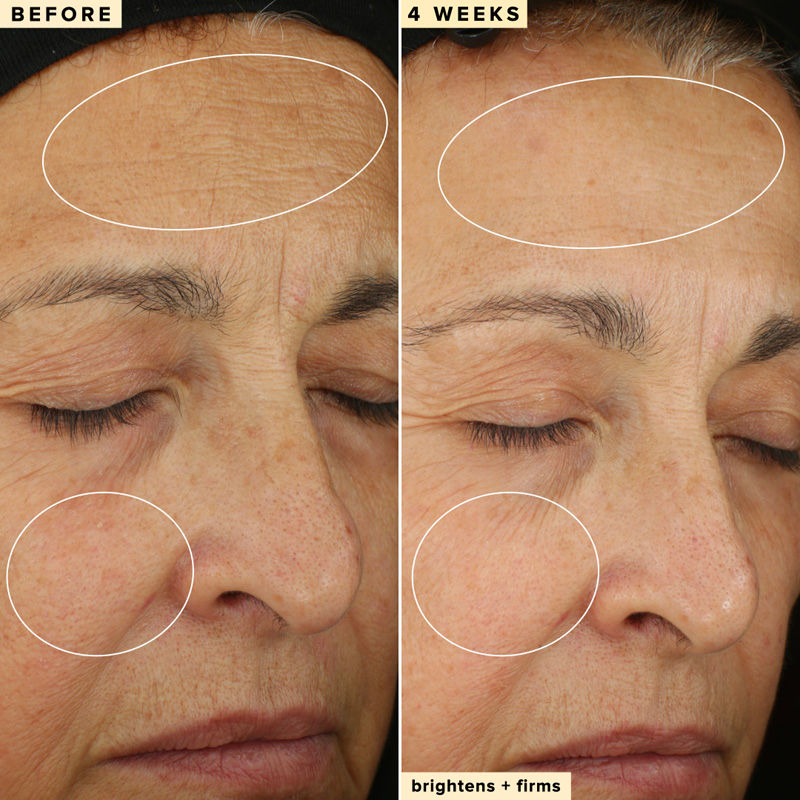 10% Waterless Vitamin C Serum