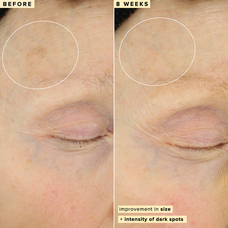 10% Waterless Vitamin C Serum