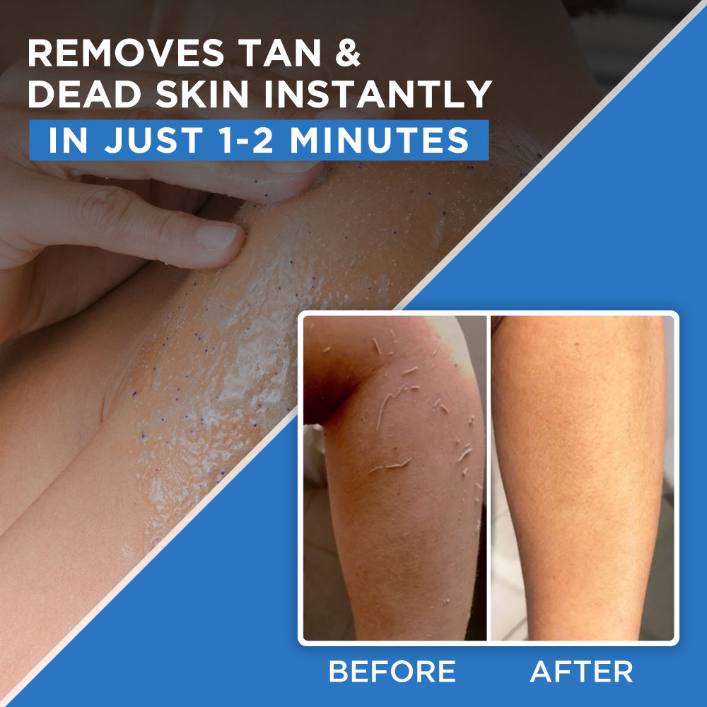 Instant Tan & Dead Skin Removal Exfoliating Gel For Women & Men - Tanning Dead Skin Remover
