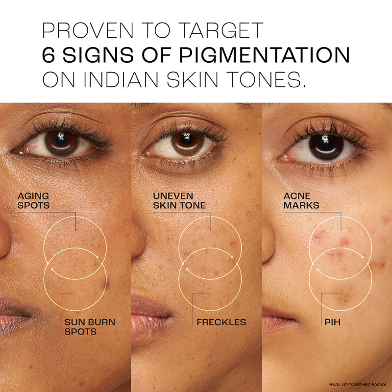 Absolute Perfect Radiance Skin Brightening Day Creme