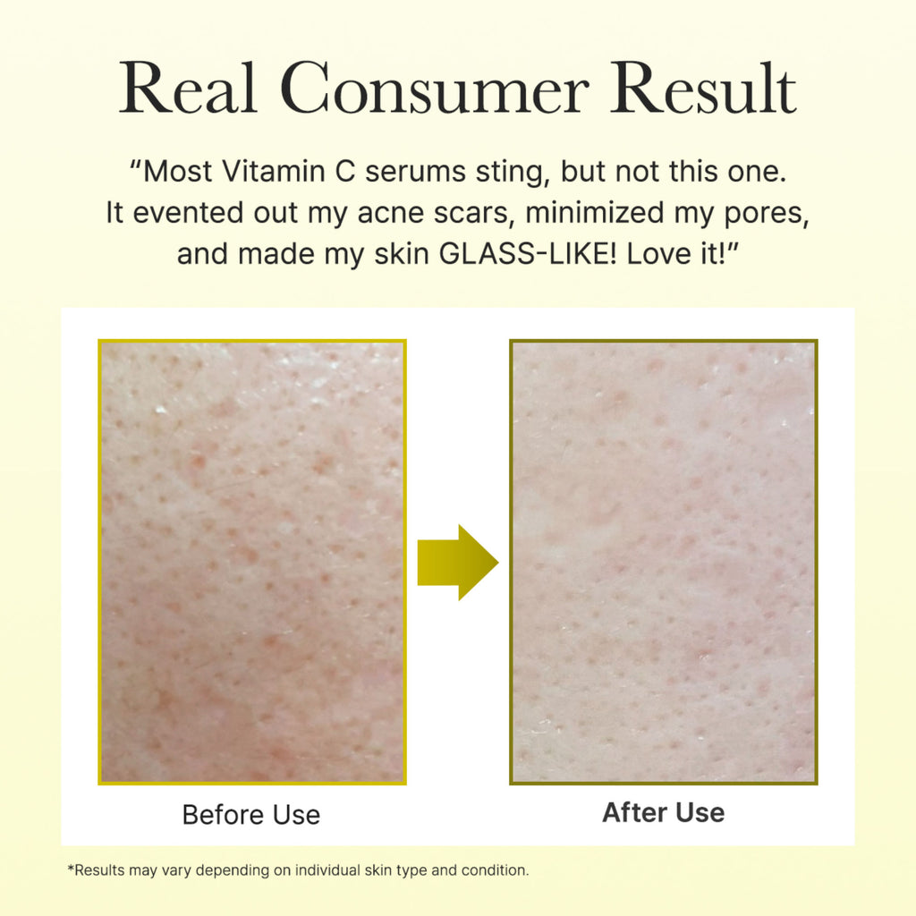 Vitamin C Booster Shot Serum with 5% Dual Vitamin C + Glutathione For Dark Spot Care