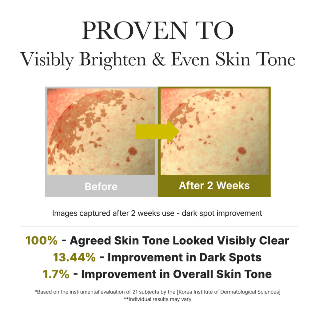 Vitamin C Booster Shot Serum with 5% Dual Vitamin C + Glutathione For Dark Spot Care