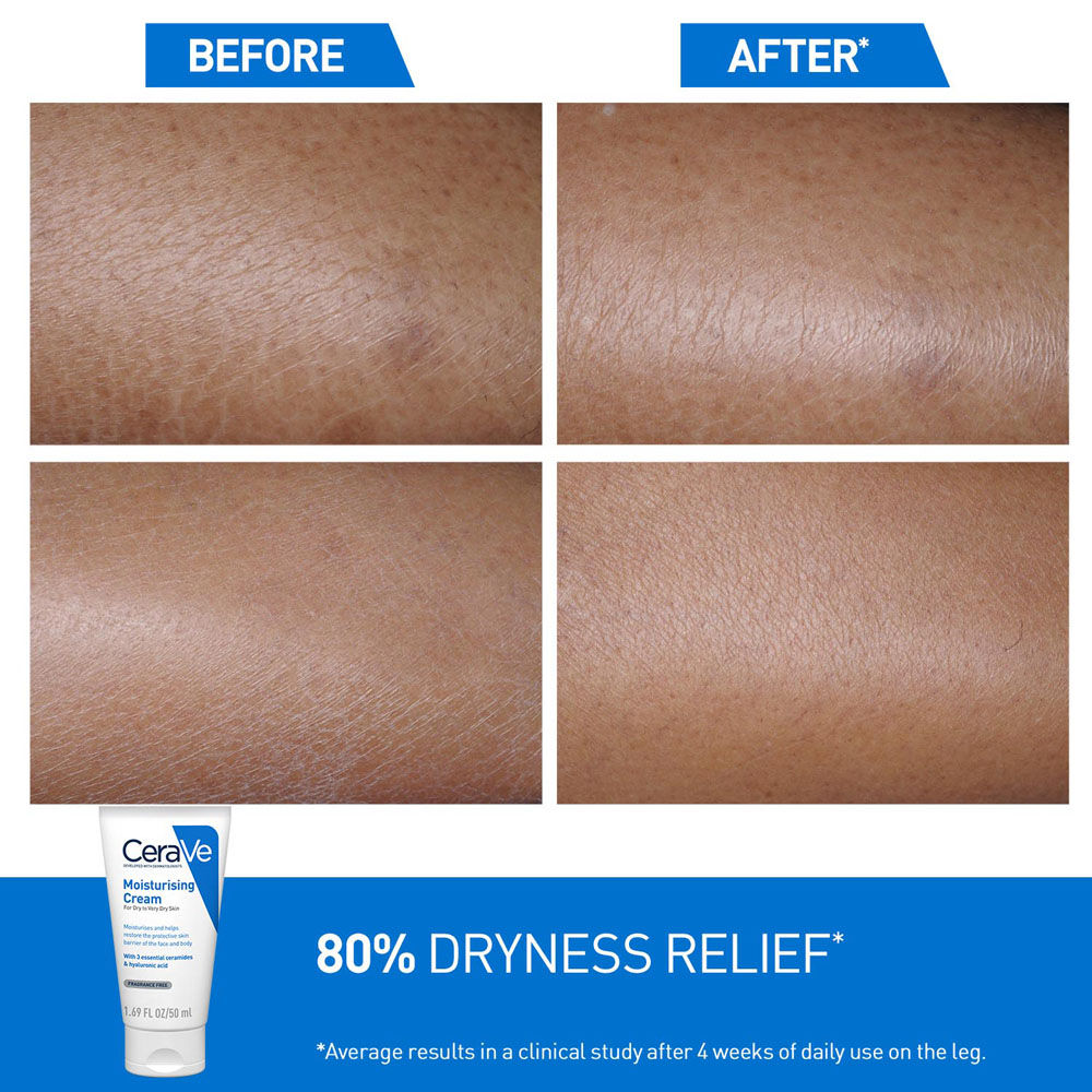 Moisturizer Cream For Dry Skin With Ceramides & Hyaluronic Acid For Barrier Repair