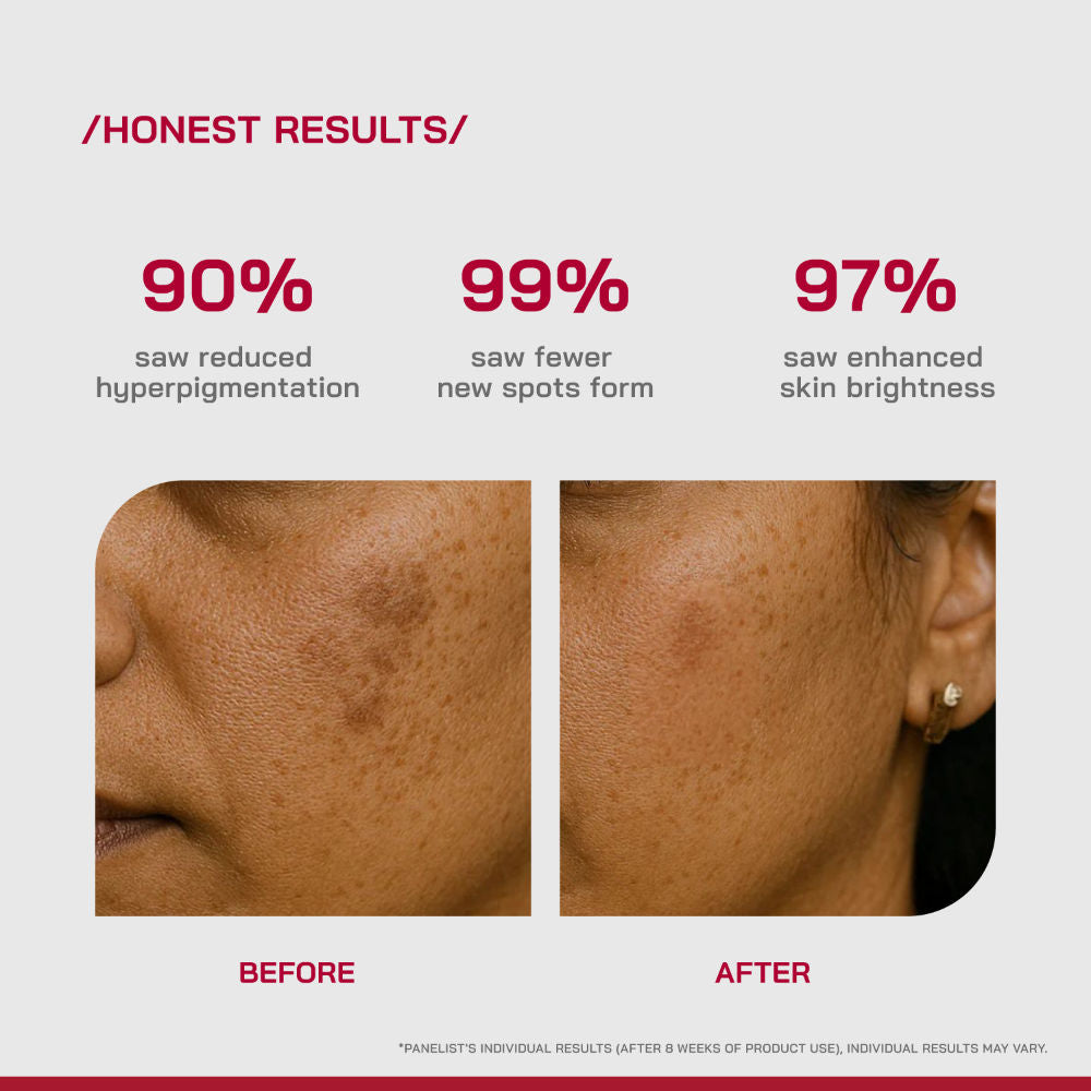 (PHD) 2% Alpha Arbutin Serum