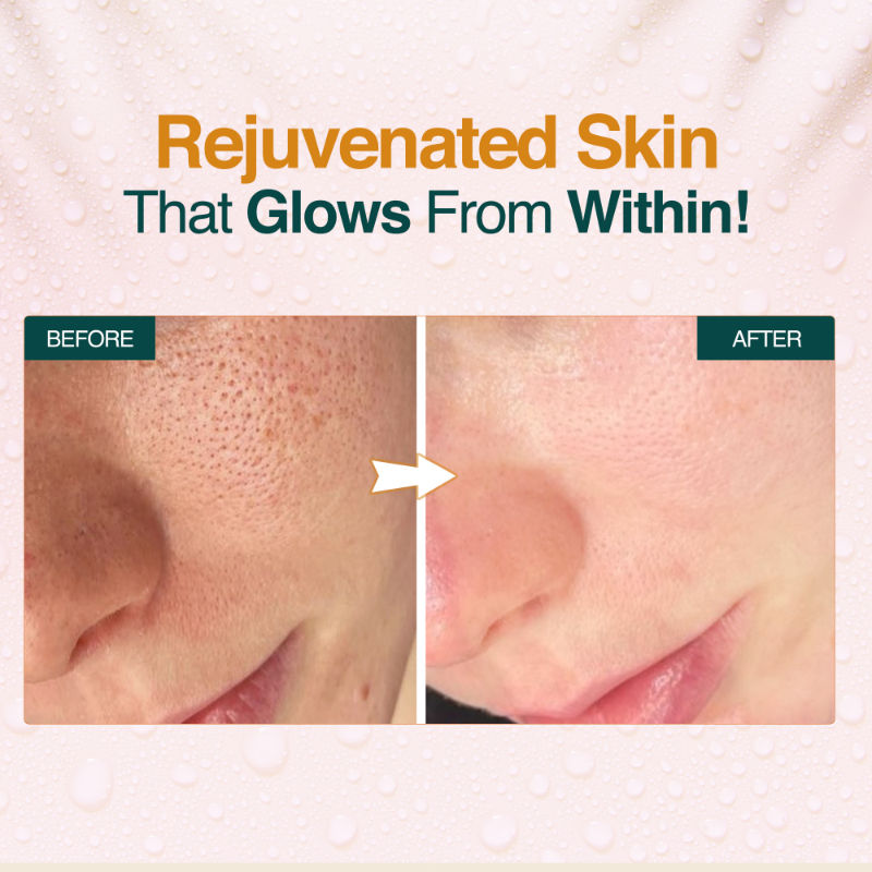 Nourish Mantra’s Dewy Rose Toner to Calm Inflamed Skin
