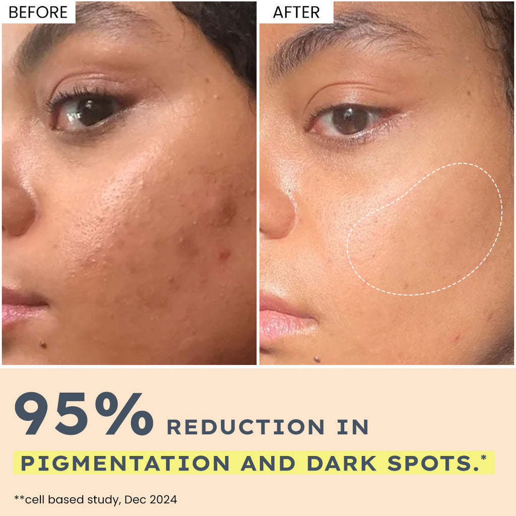 44% Rice Water Brightening Serum Pads