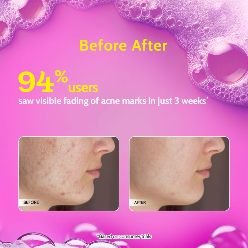 2% Salicylic Acid Face Wash For Oily Skin with Niacinamide Oil Cleanser for Face