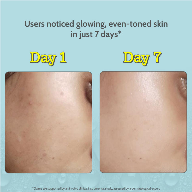 10% Vitamin C Face Serum Brightens Skin Treats Dark Spots & Hyperpigmentation