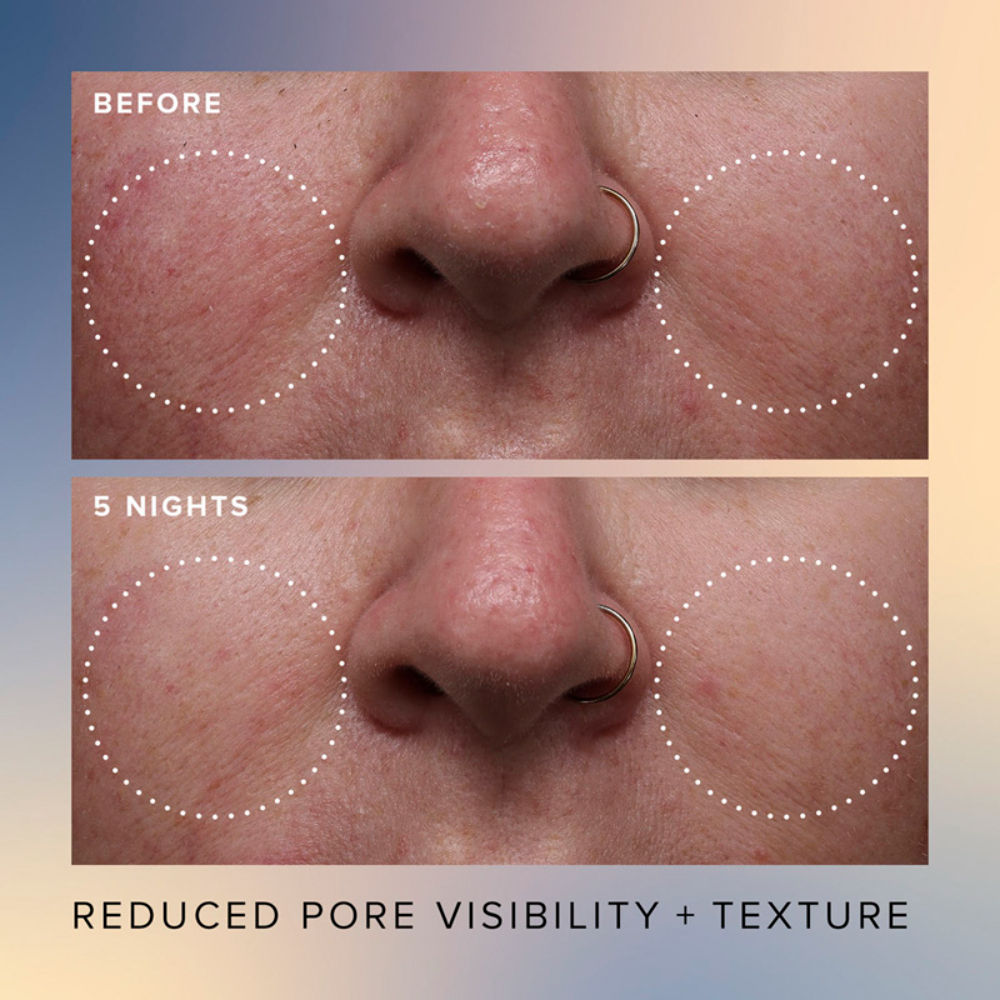 Honey Glow 17% Resurfacing Acid Serum