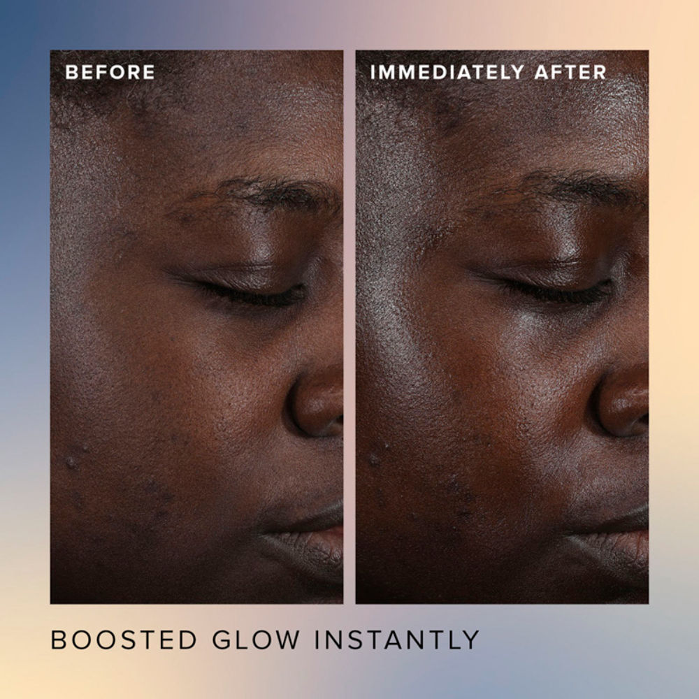 Honey Glow 17% Resurfacing Acid Serum